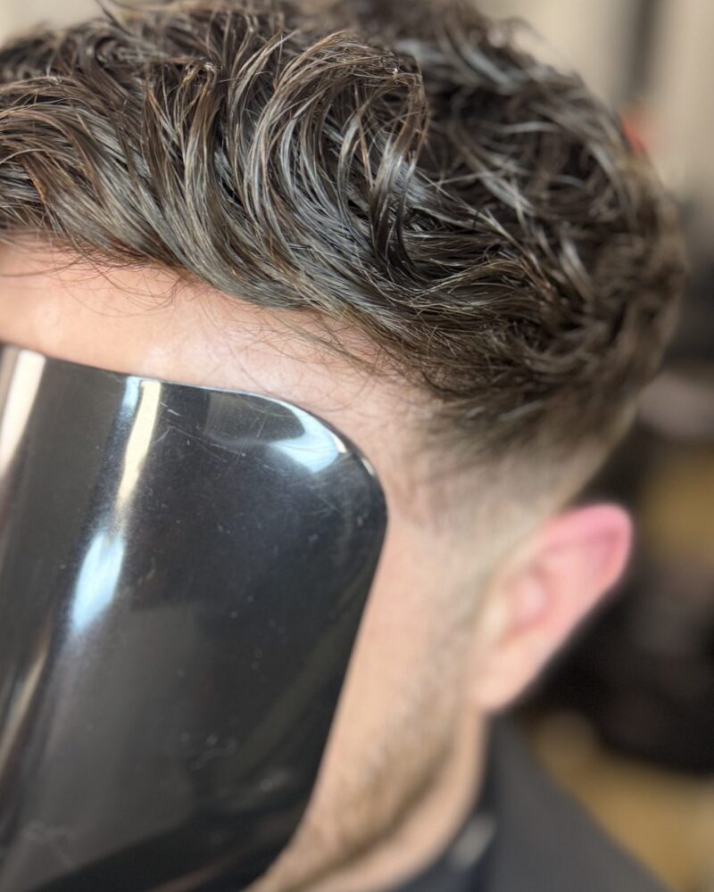 The same client after a hair system was fitted and cut in, with full coverage through the front and crown.
